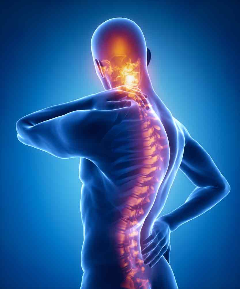 neck-back-pain-oakland-physical-therapy-SOL-409424113-1.jpg